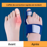 Correcteur Hallux Valgus Articulé – Redressement Progressif & Soulagement Durable