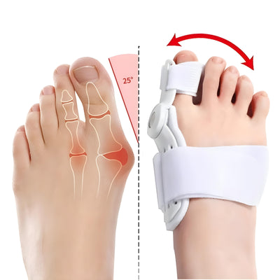 Correcteur Hallux Valgus Articulé – Redressement Progressif & Soulagement Durable