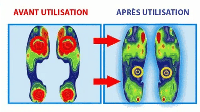 Chaussures orthopédiques en similicuir pour femme – Style moderne